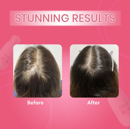 Hair-Regrowth Spray 2.0