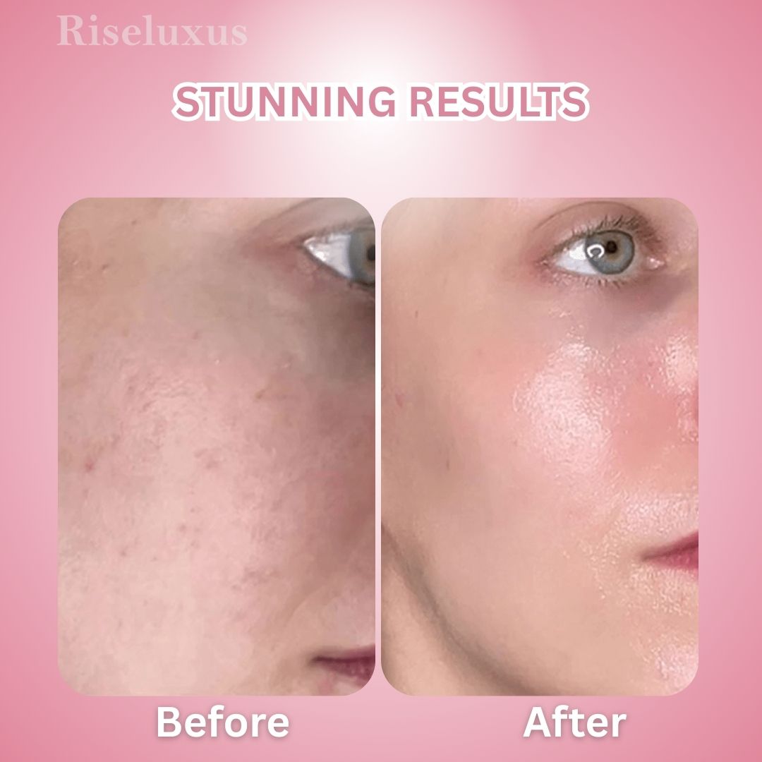 Turmeric & Kojic Acid Pads